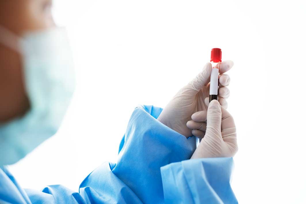 Những xét nghiệm máu khi mang thai mẹ bầu nên thực hiện